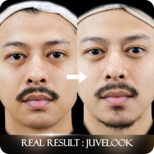 JUVELOOK